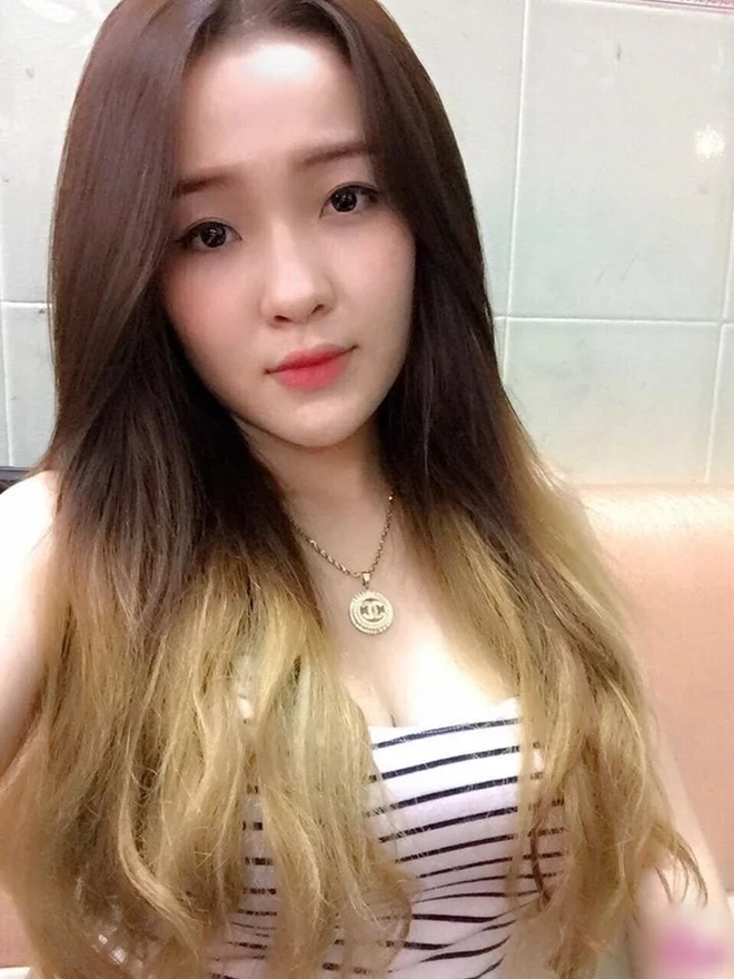 10 năm qua ngân 98 từng nghiện phẫu thuật thẩm mỹ ra sao - 3