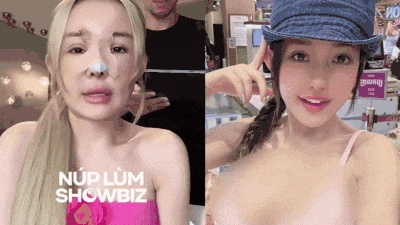 10 năm qua ngân 98 từng nghiện phẫu thuật thẩm mỹ ra sao - 4