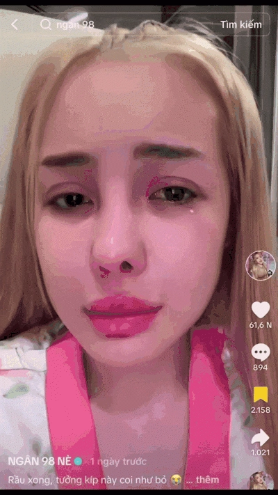 10 năm qua ngân 98 từng nghiện phẫu thuật thẩm mỹ ra sao - 5