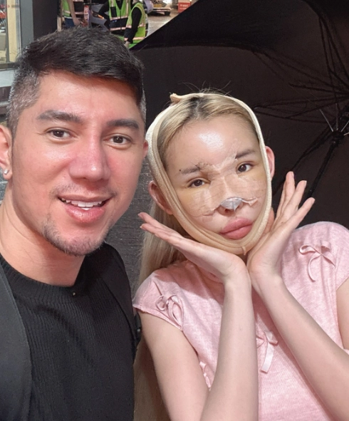 10 năm qua ngân 98 từng nghiện phẫu thuật thẩm mỹ ra sao - 6