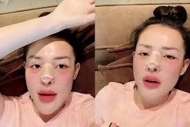 10 năm qua ngân 98 từng nghiện phẫu thuật thẩm mỹ ra sao - 9