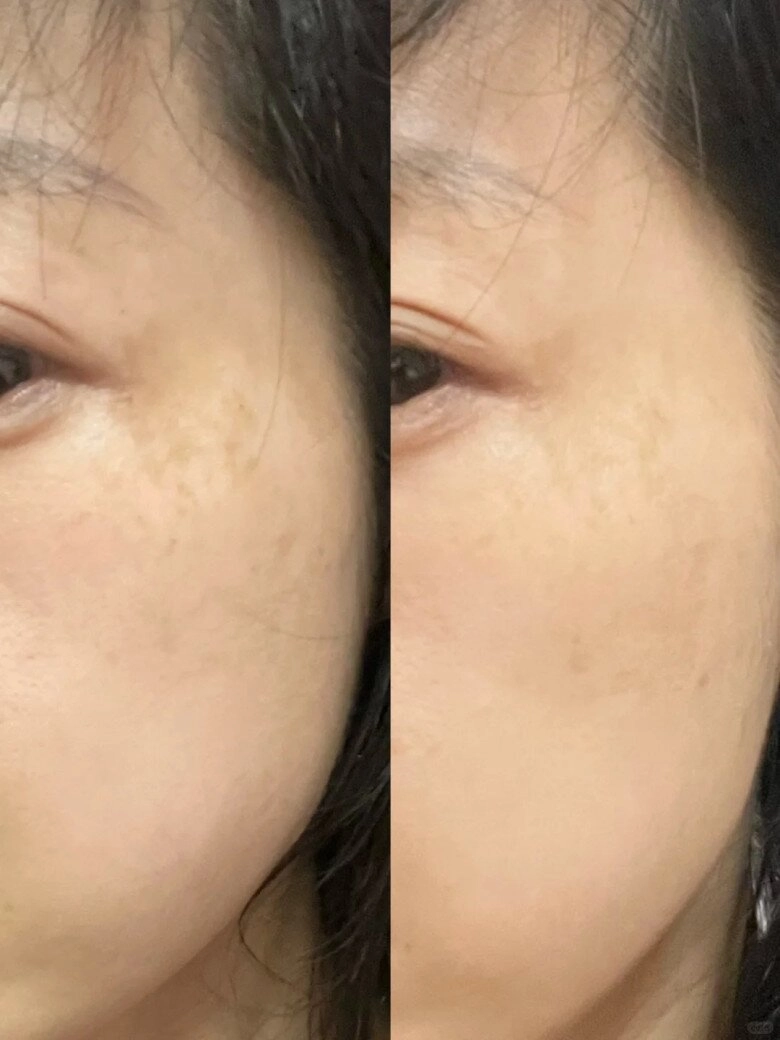 Con gái trung quốc có làn da trắng sáng như tấm phản quang nhờ ngâm mặt nạ giấy với hạt siêu thực phẩm - 2