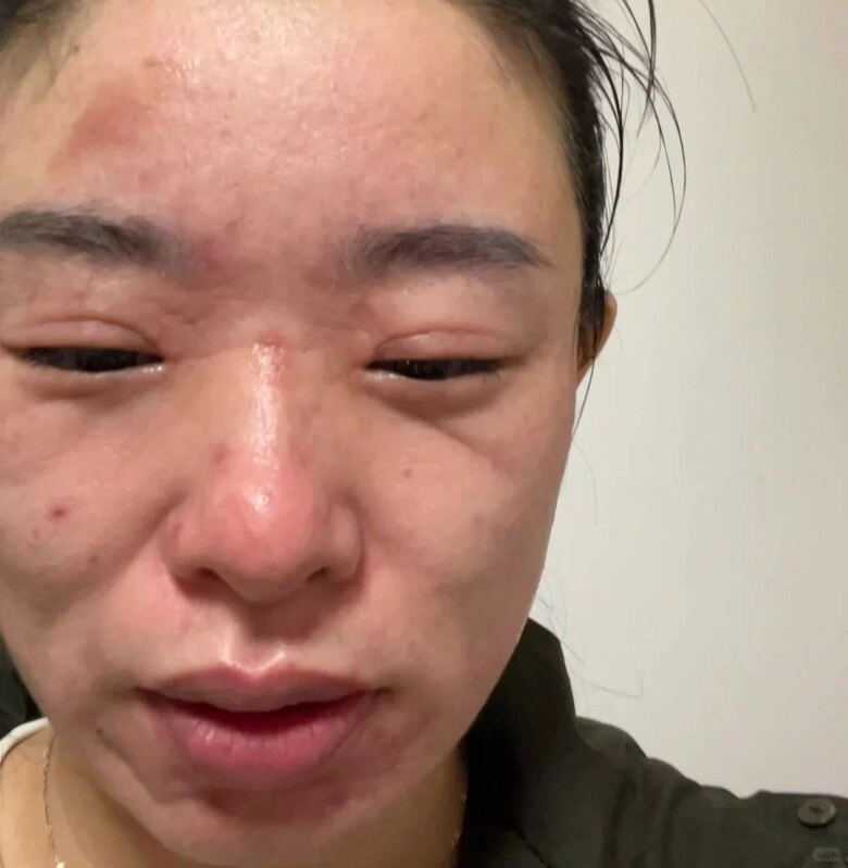 Con gái trung quốc có làn da trắng sáng như tấm phản quang nhờ ngâm mặt nạ giấy với hạt siêu thực phẩm - 7