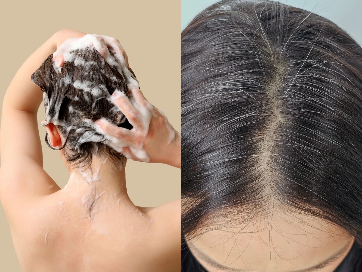 Gội đầu không đúng cách có thể khiến tóc bạc mọc nhiều hơn nhiều người mắc phải những sai lầm này mỗi ngày - 2