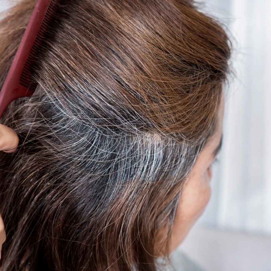 Gội đầu không đúng cách có thể khiến tóc bạc mọc nhiều hơn nhiều người mắc phải những sai lầm này mỗi ngày - 6