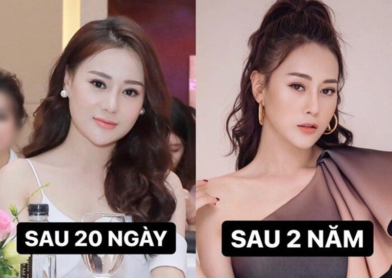 Netizen đào lại nhan sắc thời chưa nổi tiếng của phương oanh - 7