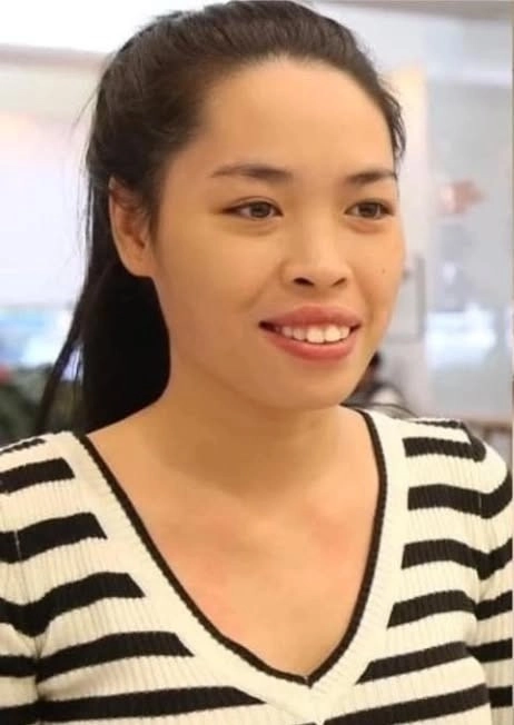 Nhan sắc hiện tại của hot girl từng lột xác nhờ phẫu thuật thẩm mỹ - 2