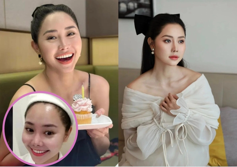 Nữ diễn viên 3 lần sửa mũi hỏng nay nhan sắc lên hương tuổi 35 - 3