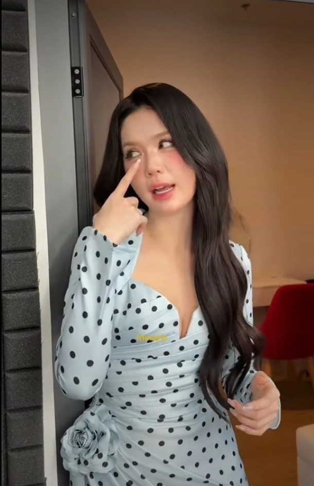 nữ hoàng nội y ngọc trinh công khai can thiệp thẩm mỹ - 2