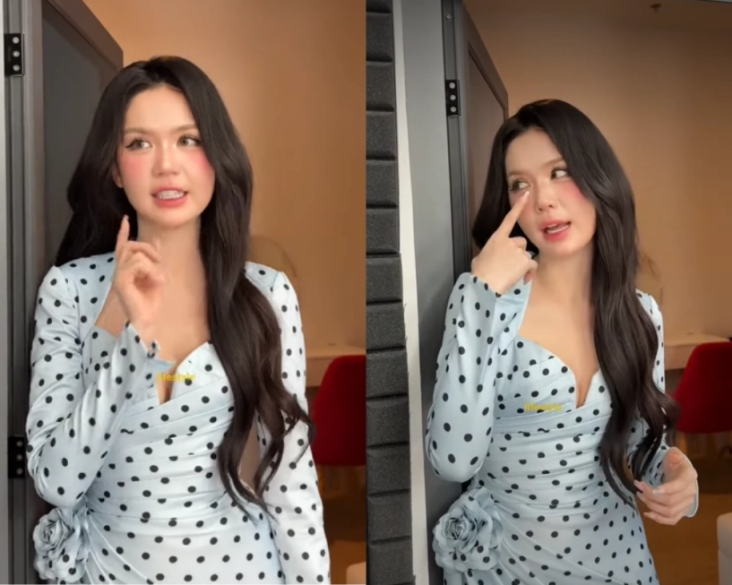 nữ hoàng nội y ngọc trinh công khai can thiệp thẩm mỹ - 3