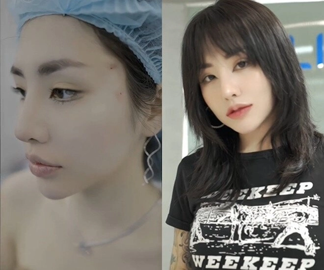 Tình cũ đạt g hiện tại nhan sắc lạ lẫm hậu dao kéo mặc khoét hở tận hông khoe body nóng bỏng - 2