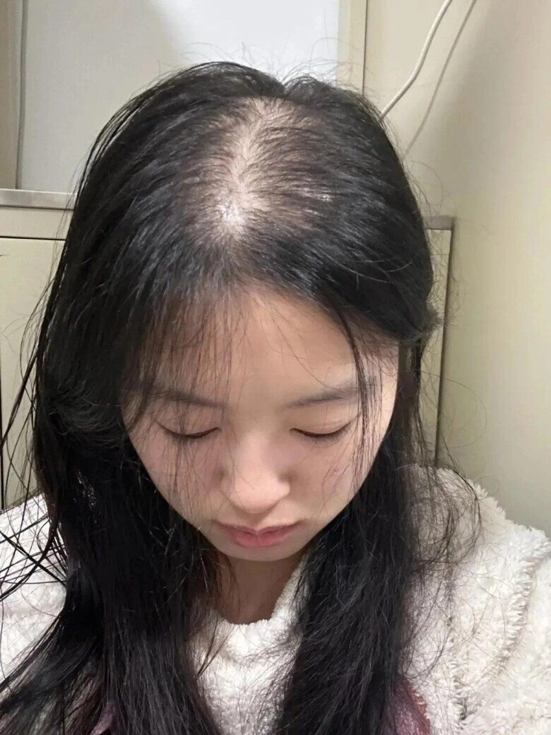 Tóc mọc chậm mãi không dài lại hay rụng nhiều thử ngay bí quyết giúp tóc dài gấp đôi trong 1 tháng của gái hàn - 1