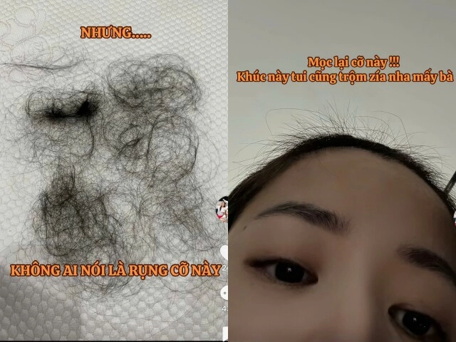 Từ chuyện puka rụng tóc cả nắm sau sinh dân tình chỉ ngay 5 bí quyết dân gian giúp mọc tóc từ loạt thần dược vừa rẻ vừa hiệu quả - 1