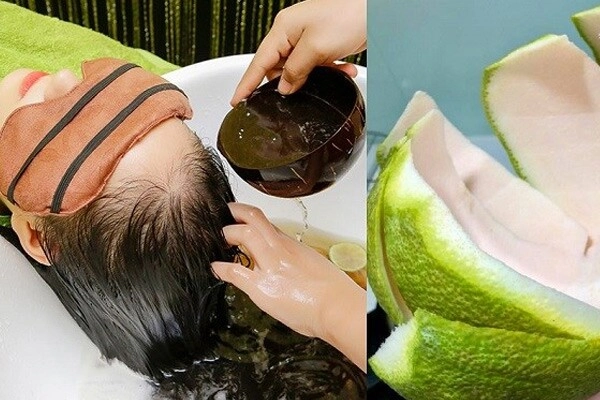 Từ chuyện puka rụng tóc cả nắm sau sinh dân tình chỉ ngay 5 bí quyết dân gian giúp mọc tóc từ loạt thần dược vừa rẻ vừa hiệu quả - 3