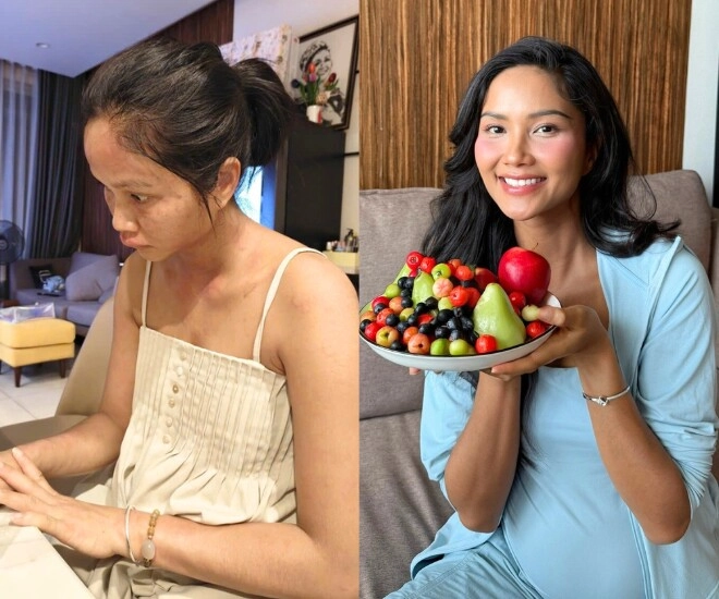 Chi nửa tỷtháng để ở cữ hhen niê nay biến dạng ngoại hình vì bệnh lạ sau sinh chỉ 110 người gặp phải - 1