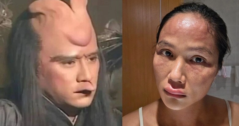 Chi nửa tỷtháng để ở cữ hhen niê nay biến dạng ngoại hình vì bệnh lạ sau sinh chỉ 110 người gặp phải - 2