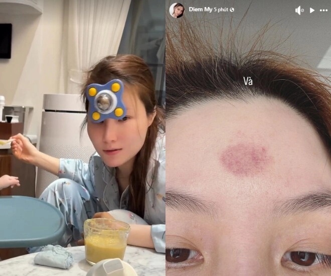 Diễm my 9x chăm con trai đến bầm tím cả trán quý tử chưa tròn 1 tuổi đã phải học cả núi sách - 1