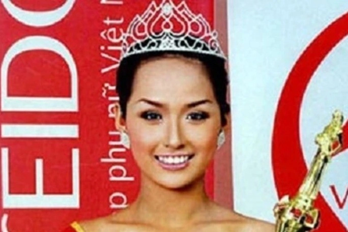 Hoa hậu việt bị tai nạn trước đêm chung kết vừa đăng quang đã rớt vương miện từ chối đi thi miss world giờ ra sao - 1