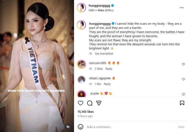 Hương giang lấy lại phong độ sau màn thi bikini gây tranh cãi đẹp như nữ thần với khuyết điểm kim cương từng muốn che - 4