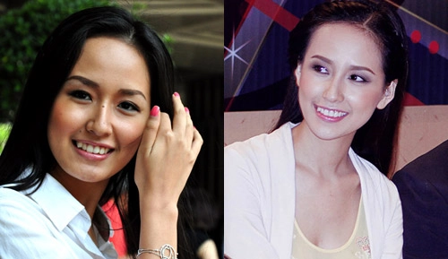 Hồ quỳnh hương lại tiếp tục dao kéo - 12