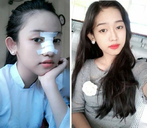 Hot girl trong chuyện tình midu - phan thành pttm từ năm 16 tuổi - 1