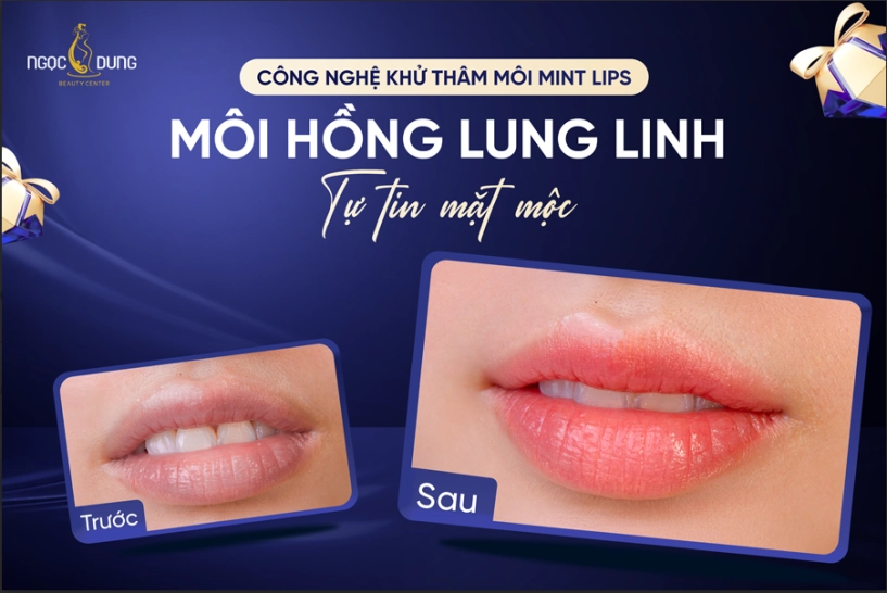 Khử thâm môi mint lips có thật sự làm sáng môi chỉ sau 1 buổi không - 1