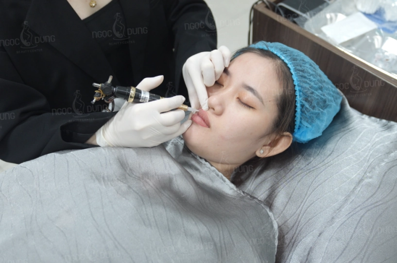 Khử thâm môi mint lips có thật sự làm sáng môi chỉ sau 1 buổi không - 2