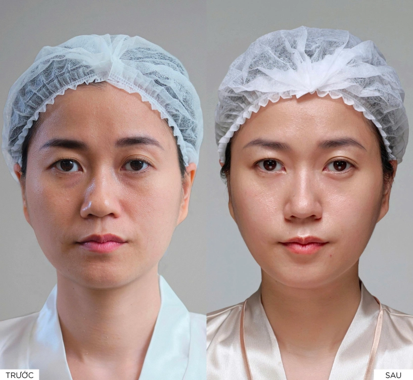 Lâm vỹ dạ làm đẹp là hành trình khoa học không phải phép màu tức thì - 2