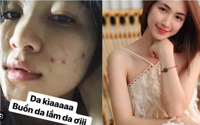 Người việt có loại lá tốt ngang kem chống nắng trị mụn hiệu quả đến hòa minzy cũng thích nhưng nhiều chị em không dám dùng - 2