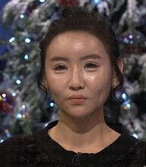 Phẫu thuật 20 lần để giống búp bê barbie - 1