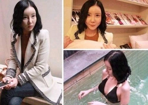 Phẫu thuật 20 lần để giống búp bê barbie - 3