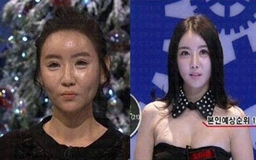 Phẫu thuật 20 lần để giống búp bê barbie - 8