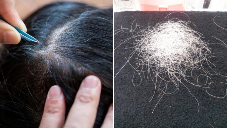 Tại sao nhổ tóc bạc càng nhiều càng làm tóc nhanh rụng ăn 2 món bổ thận tăng khí huyết này tóc sẽ trông đen lại - 2