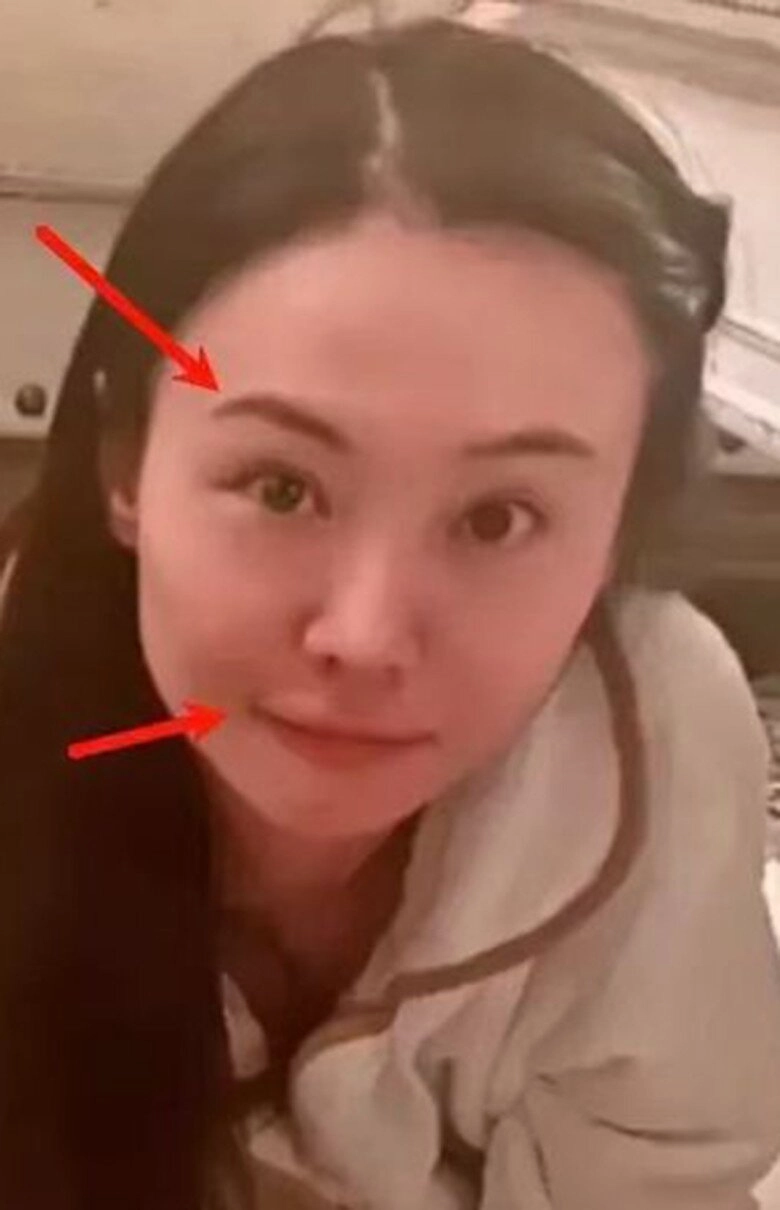 Không nhận ra nhan sắc nữ thần thanh xuân một thời gương mặt cứng đờ với đôi môi ếch kỳ lạ - 2